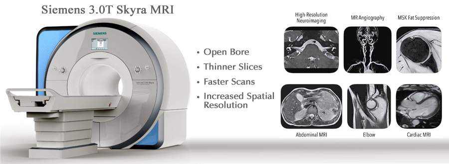 Siemens 3.0T Skyra